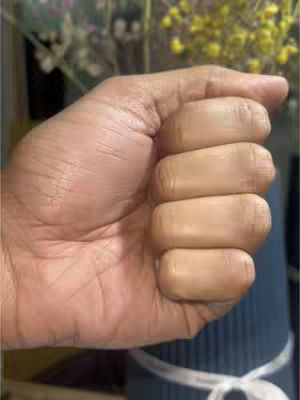 The image shows a close-up of a person's hand, with the fingers tightly clenched in a fist. The skin tone appears to be light brown. The background is blurred but suggests an indoor setting with foliage and possibly a dark blue cylindrical object with a white ribbon around it.